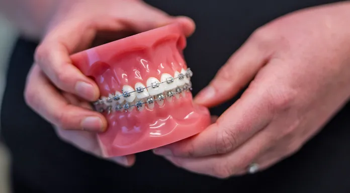 Hobart Specialist Dental Centre braces