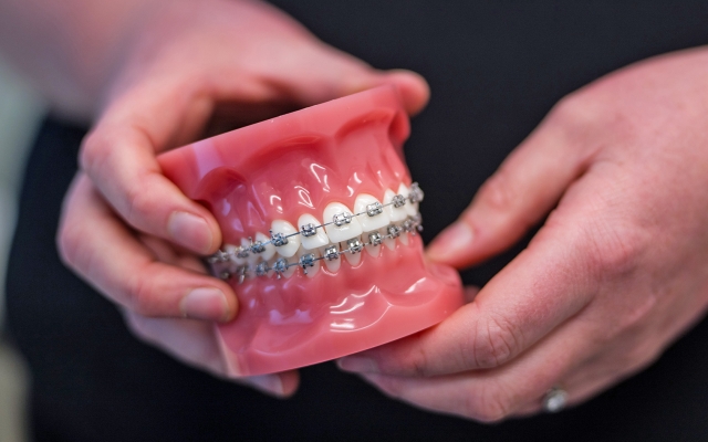 Hobart Specialist Dental Centre braces